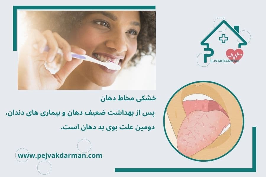 خشکی مخاط دهان پس از بهداشت ضعیف دهان و بیماری های دندان، دومین علت بوی بد دهان است.